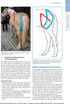 Kinesiotaping beim Pferd - Seite 127 zeigt Text, Foto und Abbildung zu "Spasmen und Atrophien des M. biceps femoris"