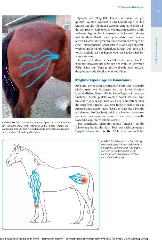 Kinesiotaping beim Pferd - Seite 131 zeigt mögliche Tapeanlagen bei Hämatomen des Pferdes mit Text, Foto und Abbildung