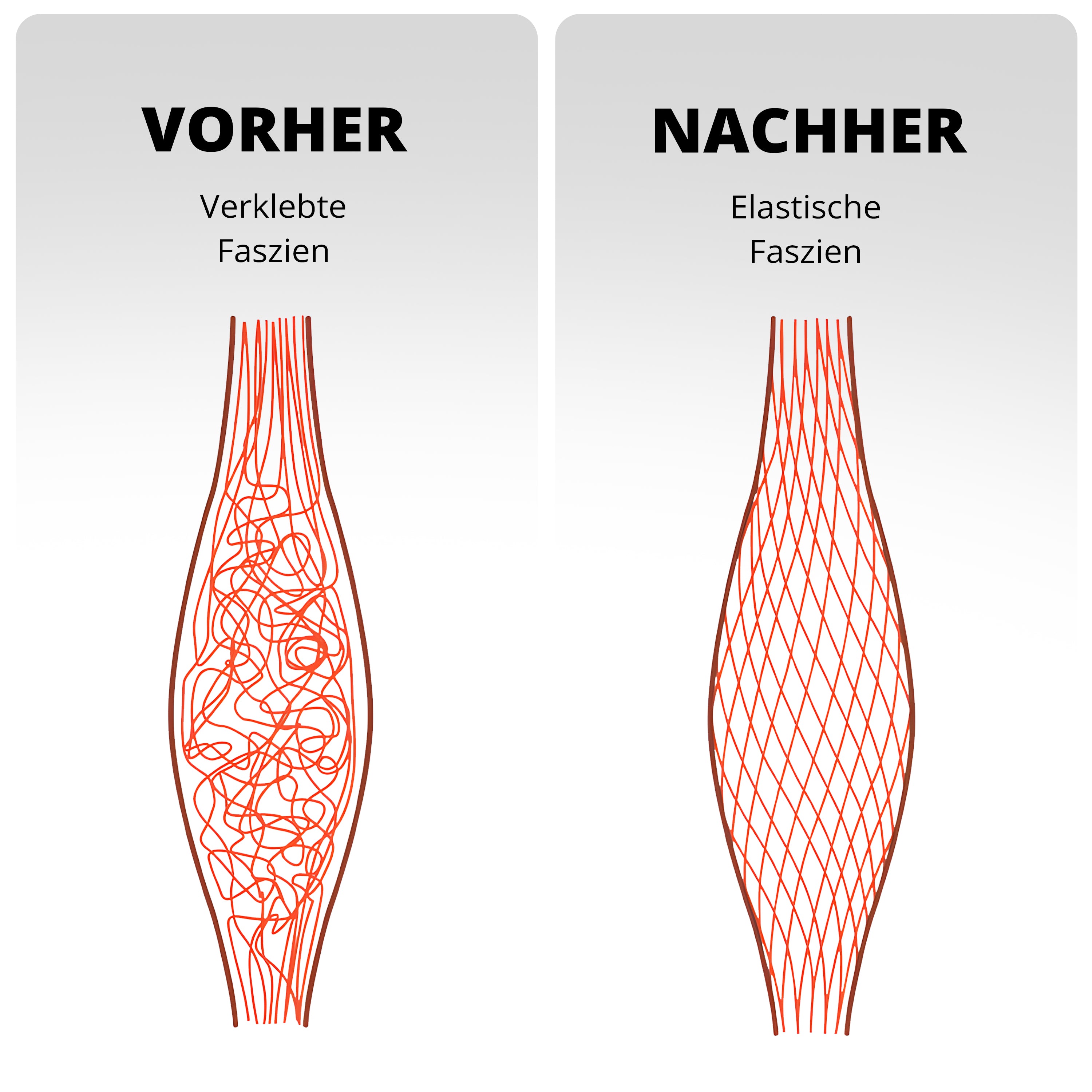 Vergleichsbild: verklebte Faszien vor regelmäßiger Anwendung der NeedleyRoll Faszienrolle gegenüber elastischen Faszien durch Faszientherapie
