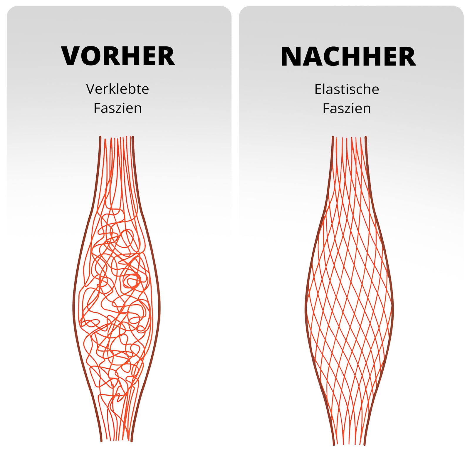Vergleichsbild: verklebte Faszien vor regelmäßiger Anwendung der NeedleyRoll Faszienrolle gegenüber elastischen Faszien durch Faszientherapie