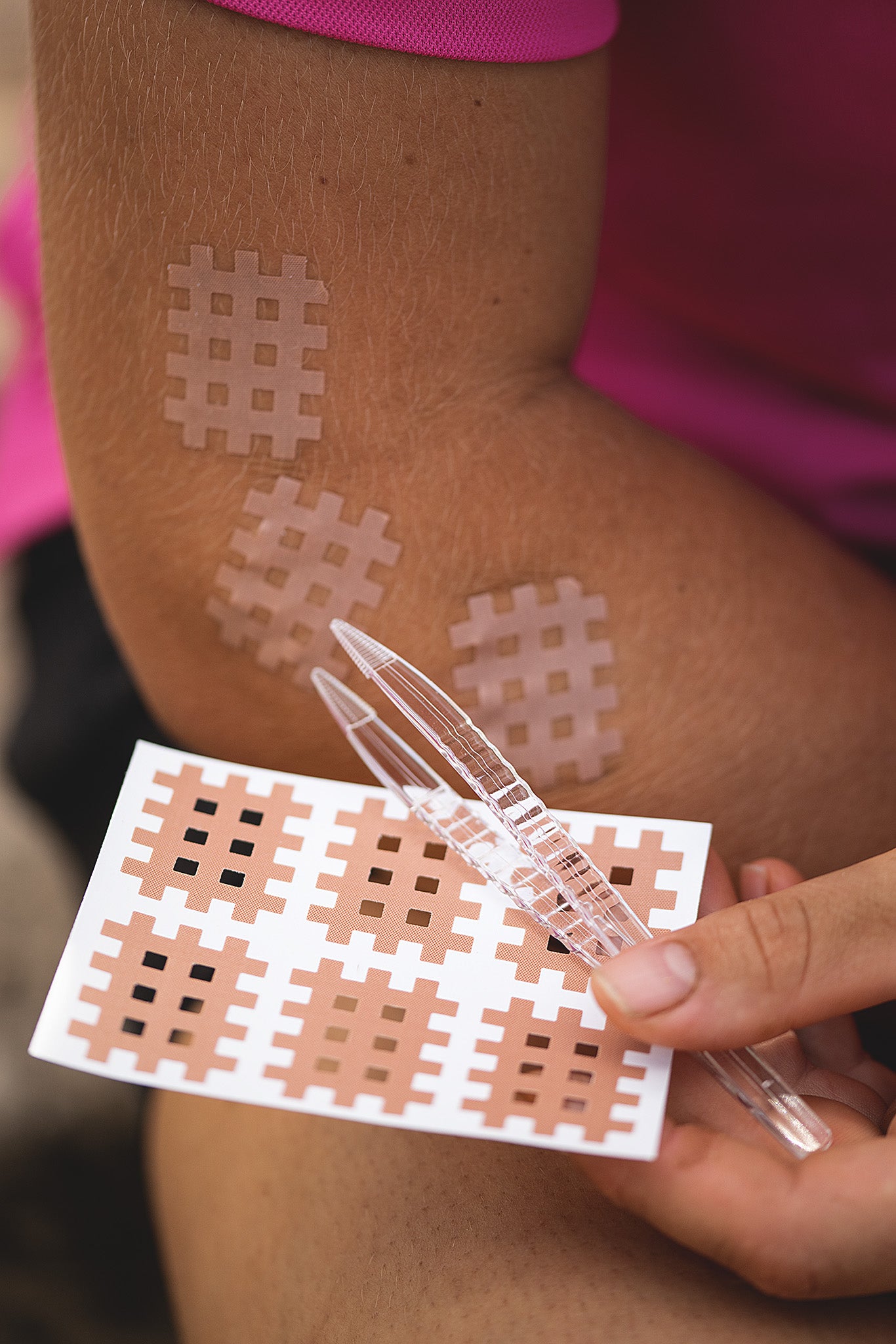 Cross Tape Typ B auf Triggerpunkt am Ellenbogen geklebt